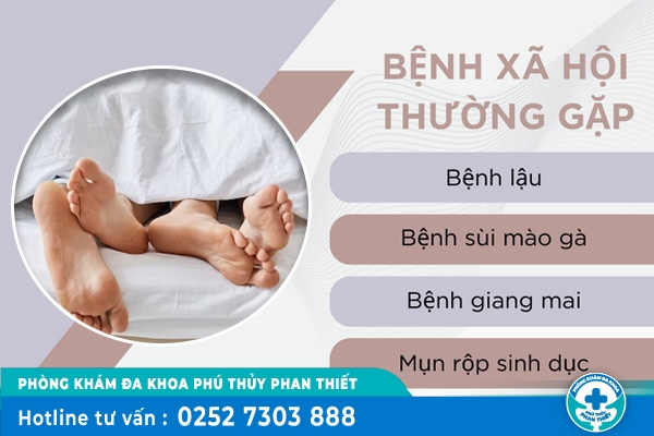 Một số triệu chứng bệnh xã hội cần lưu ý