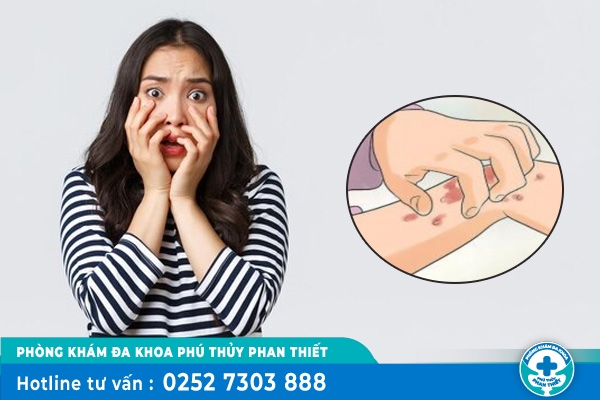 Hình ảnh các giai đoạn mắc bệnh giang mai