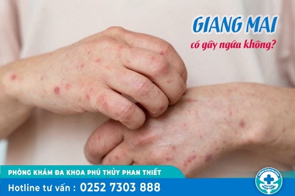 Giang mai có ngứa không? Phải làm sao để điều trị căn bệnh này?