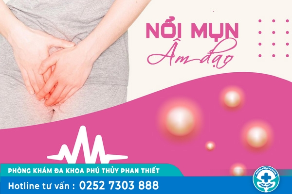 Nổi mụn âm đạo là dấu hiệu bất thường - Phái nữ đừng nên phớt lờ
