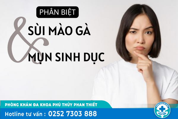 Phân biệt mụn sinh dục và sùi mào gà
