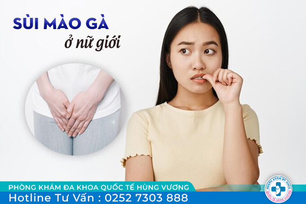 Sùi mào gà ở nữ và cách điều trị hiệu quả được giới chuyên môn đánh giá cao